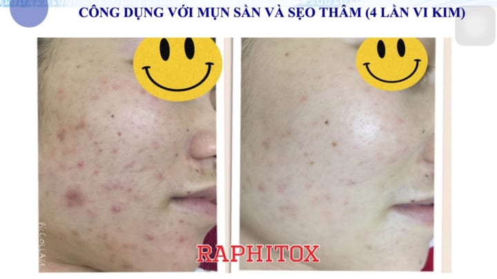 Hiệu quả vi kim sinh học
