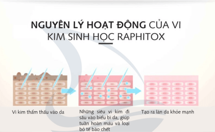 Raphitox nguyên lý hoạt động