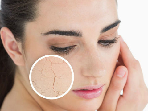 Việc thiếu nước cũng khiến da xỉn màu, kém rạng rỡ.