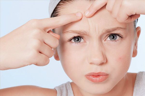 Cần tuyệt đối tránh tự nặn mụn vì nguy cơ biến mụn ẩn thành mụn viêm khó chữa.