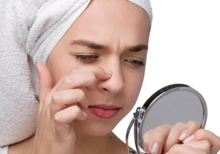 Tẩy trang chưa sạch, dẫn đến bít tắc lỗ chân lông sẽ tạo cơ hội cho mụn ẩn hình thành.