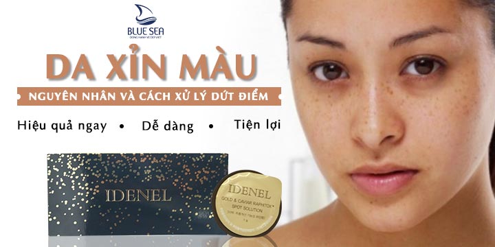 Da xỉn màu - Truy tìm thủ phạm và cách xử lý dứt điểm.