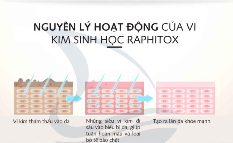 Nguyên lý hoạt động của vi kim sinh học