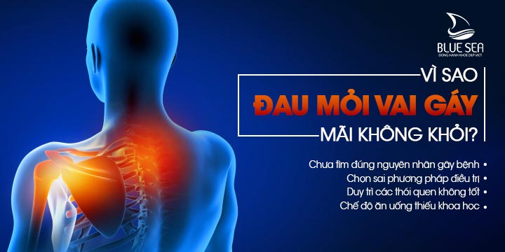 Vì sao đau mỏi vai gáy mãi không khỏi? Tìm hiểu ngay những nguyên nhân sau!