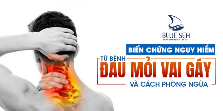 Bệnh đau vai gáy có nguy hiểm không? Những biến chứng bạn cần biết.