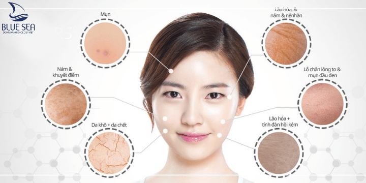 Các tình trạng thường gặp da lão hóa mùa đông.