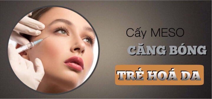 Trẻ hóa, căng bóng da bằng mesotherapy kết hợp Exosome